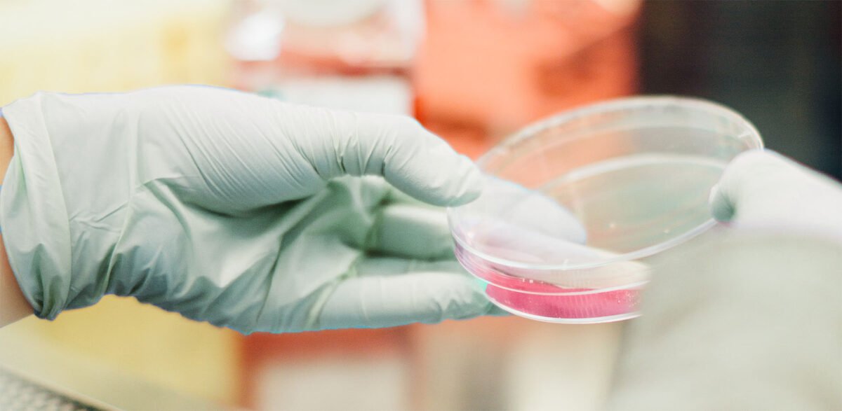 The History of Nitrile Gloves Eastwest Medico