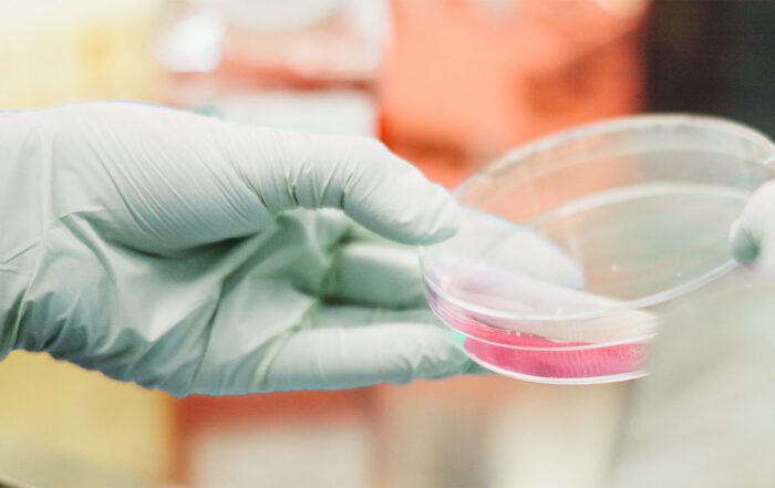 PROSENSO BIODEGRADABLE WITH CHEMICALS