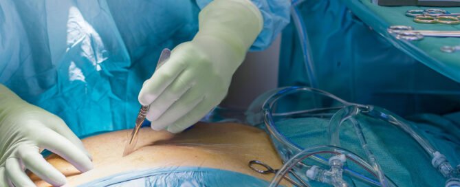 Surgeon with double gloving surgical gloves cutting in stommach